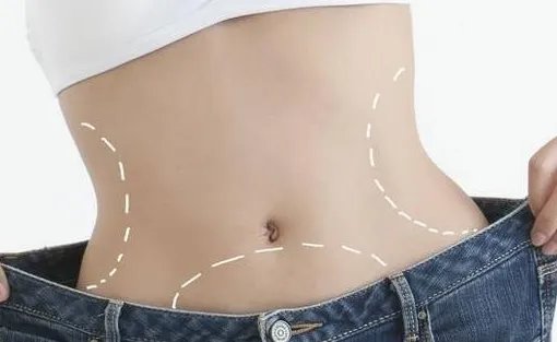 光纤溶脂好不好