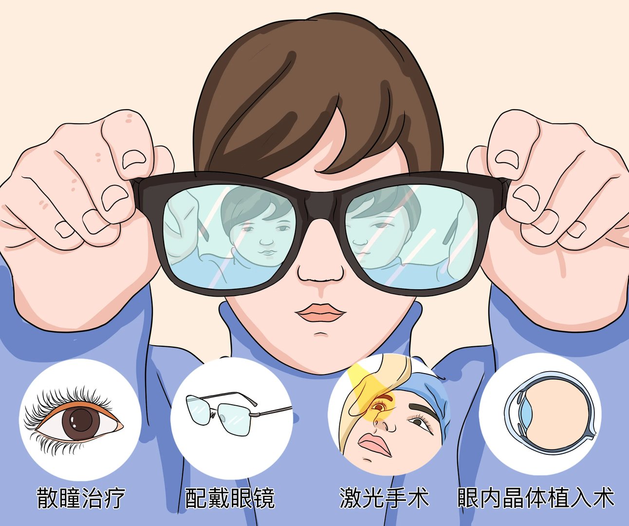 治疗近视的方法