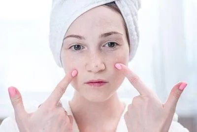 祛斑口碑最好十大排名