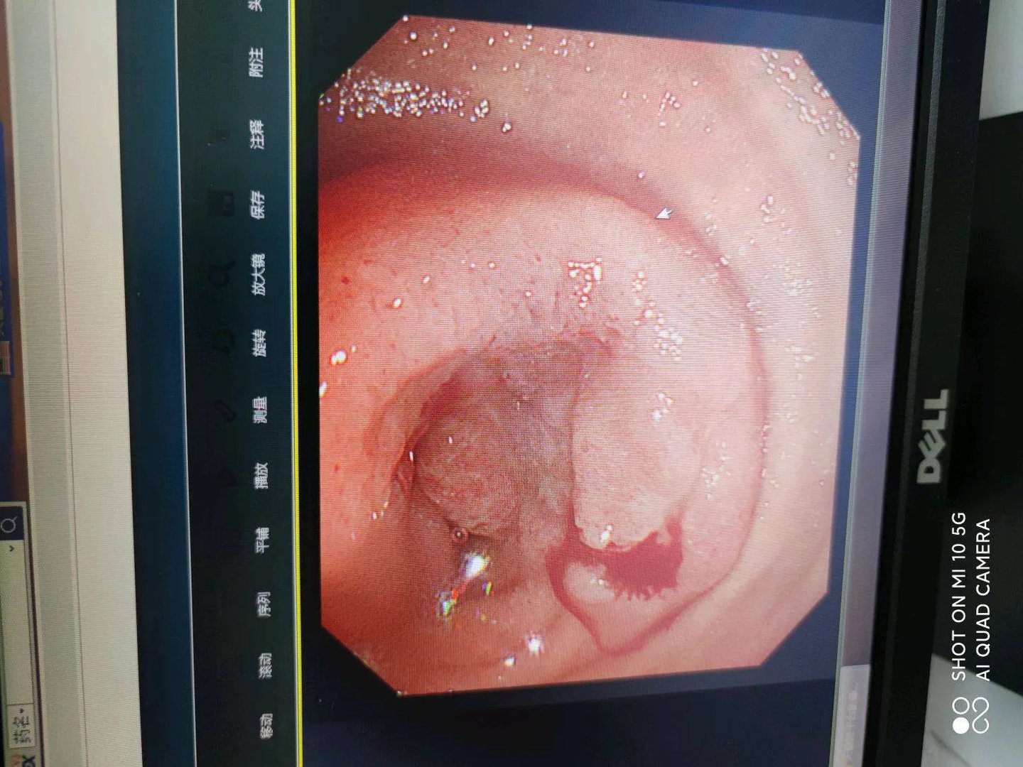 二十八个饮食小常识