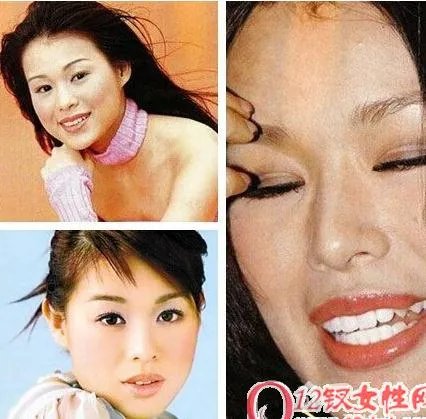 胡杏儿整容前后对比照:胡杏儿整容前后照片