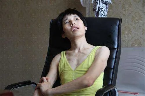 世界首例舞蹈症猪 舞蹈症是什么病