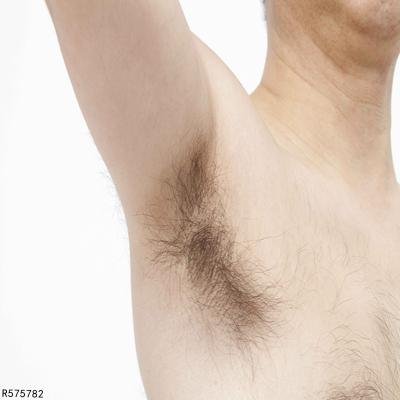 腋毛上有白色的东西怎么回事