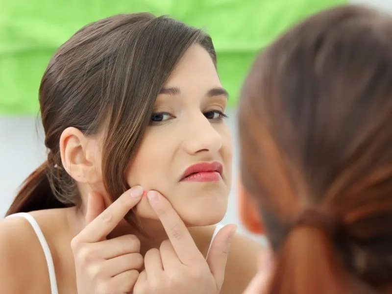 怎么祛痘去痘印