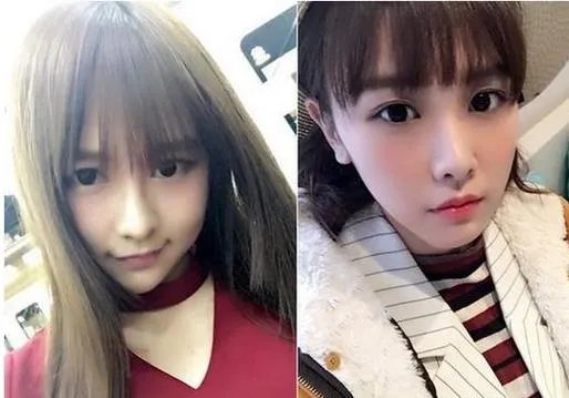 唐安琪脸部植皮：自从烧伤后网友每天都献祝福给她