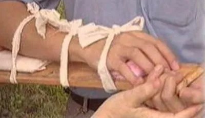 误碰女生哪里结果被打骨折？