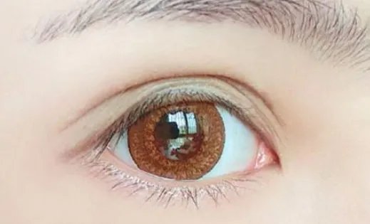 三点定位双眼皮手术多少钱