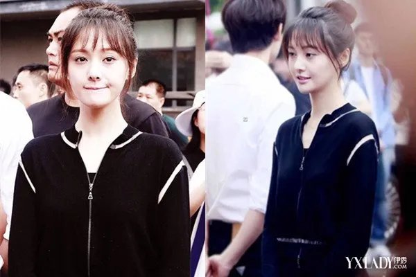 郑爽突发急性肠胃炎发博道歉引大家关注担忧