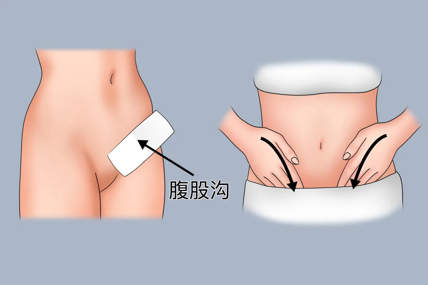 酒精擦身退烧正确部位图片