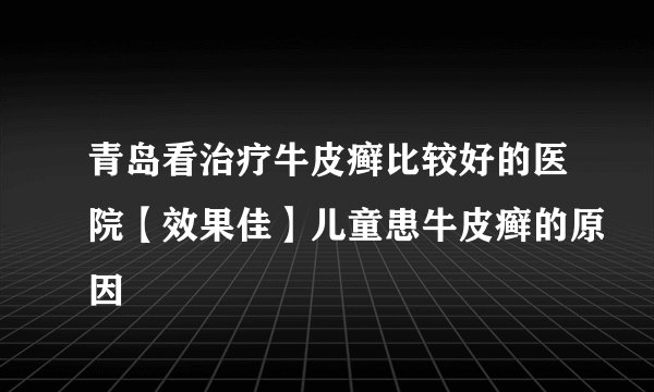 青岛看治疗牛皮癣比较好的医院【效果佳】儿童患牛皮癣的原因