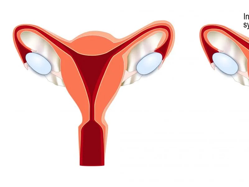 治疗停经的方法
