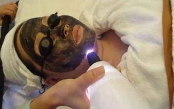 黑脸娃娃的功效