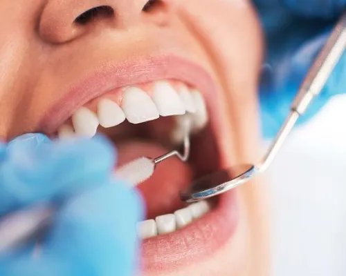 植一颗牙需要多少钱？