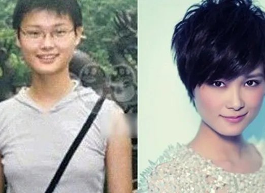 李宇春整容前后对比照曝光 曾被疑割双眼皮隆胸