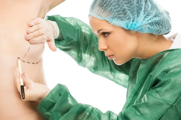 自体丰胸价格是多少