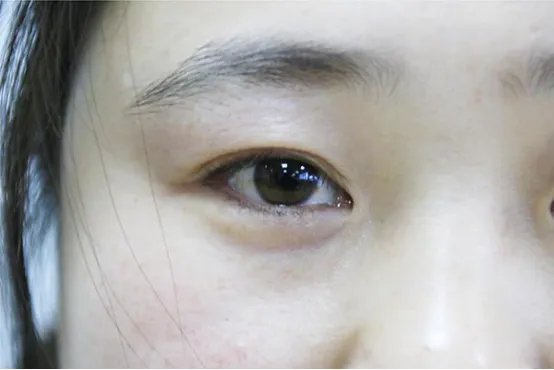 左眼皮跳是怎么回事