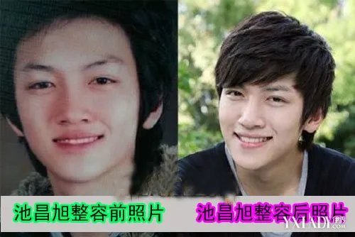 池昌旭女友身份曝光整容前后对比照惊人