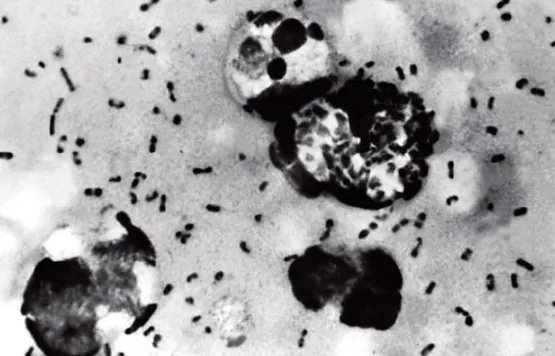 云南勐海发现1例疑似腺鼠疫病例，当地开启了哪些应急处置工作？