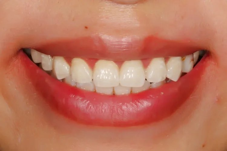 正常人的嘴唇图片