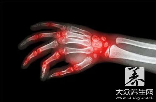  含嘌呤高的食物一览表