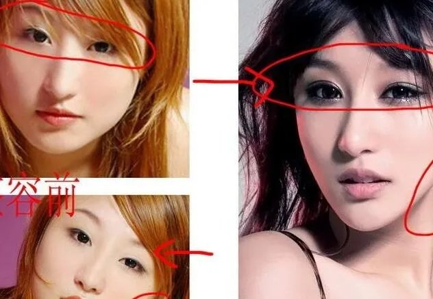 刘羽琦整容前后照片对比曝光    其承认自己整容