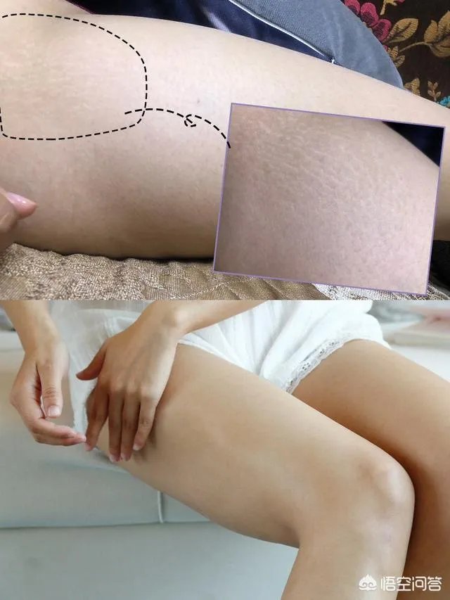 瘦身塑形的方法有哪些？