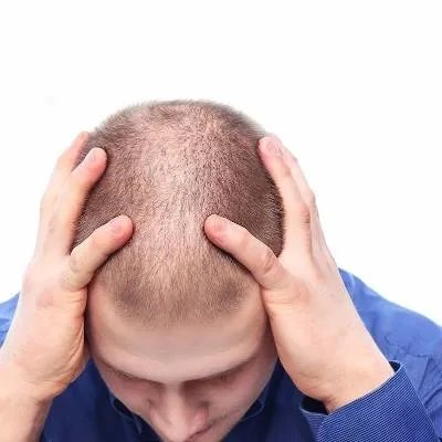 结肠癌的发病原因简介