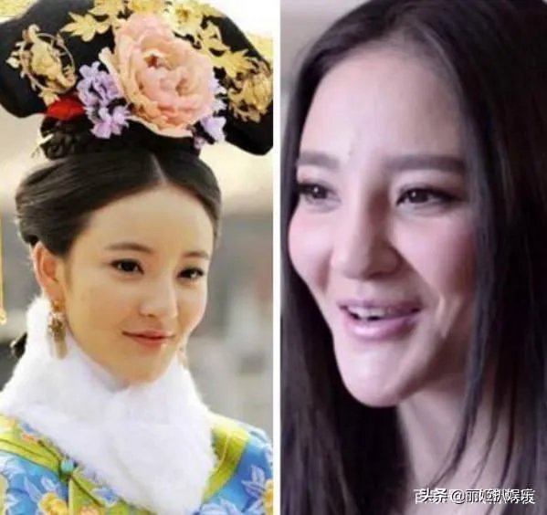 哪些女星本是天生丽质，却因整容整残了？