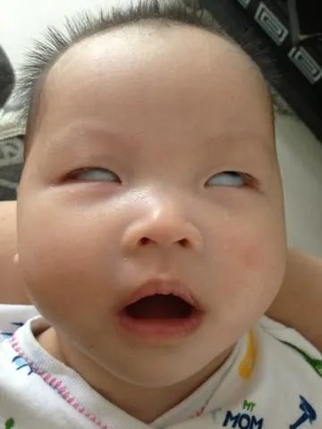 苹果8多少钱？苹果8上市价格是多少？