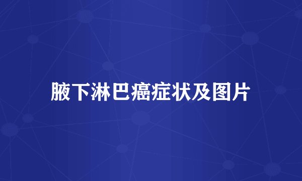 腋下淋巴癌症状及图片