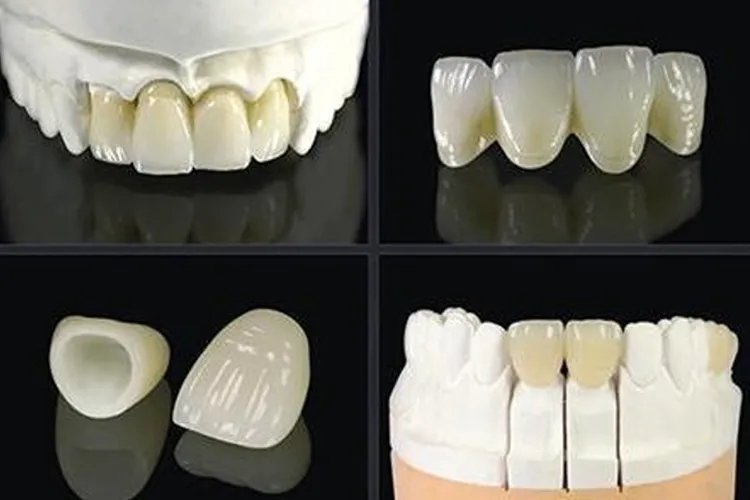 什么样的假牙最好