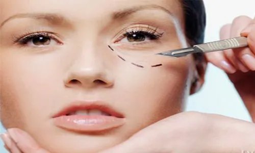 做去眼袋手术要多少钱