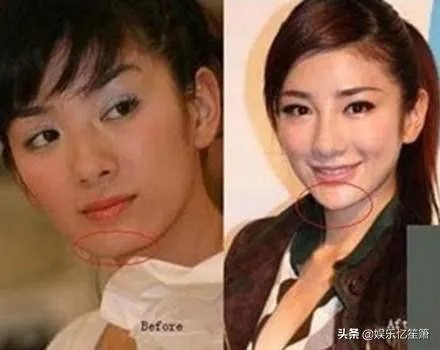 哪些女星本是天生丽质，却因整容整残了？