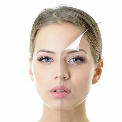 脸部长粉刺怎么办