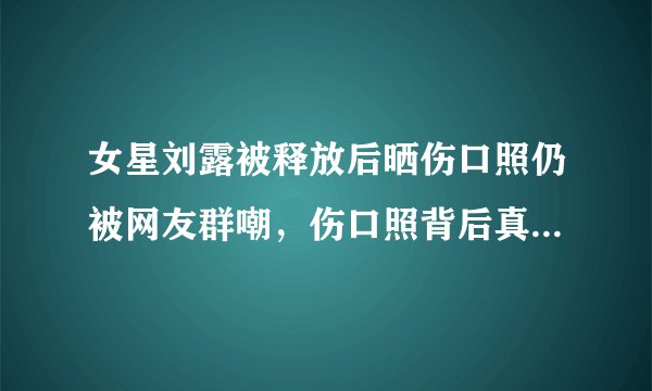 女星刘露被释放后晒伤口照仍被网友群嘲，伤口照背后真相是什么？