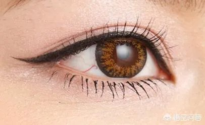 眼部整形手术的价钱是多少？