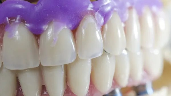 植一颗牙需要多少钱？