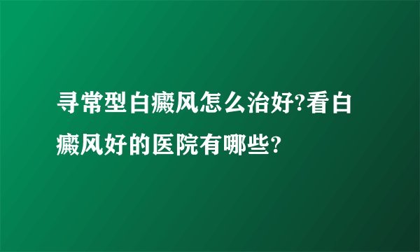 寻常型白癜风怎么治好?看白癜风好的医院有哪些?