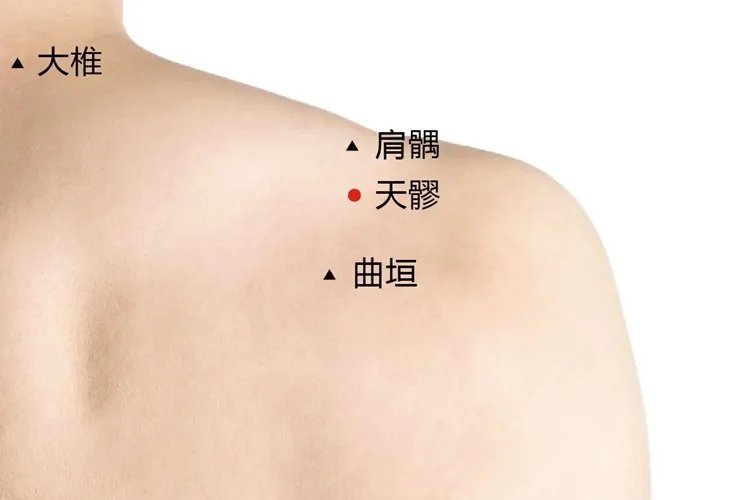 天髎的准确位置图和作用