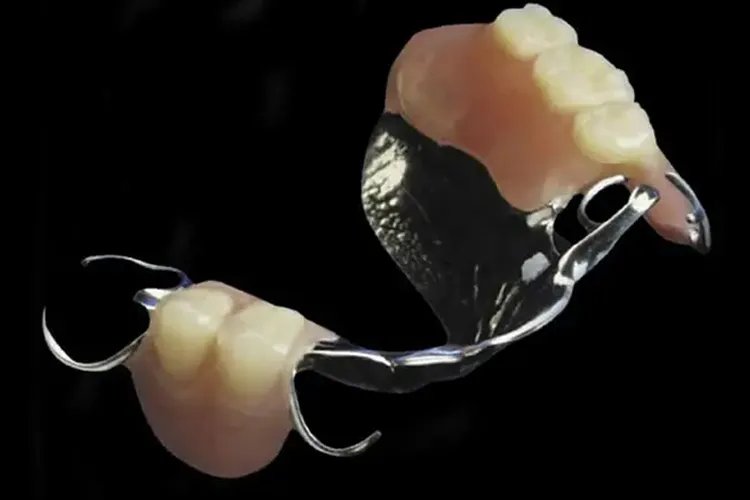 什么样的假牙最好