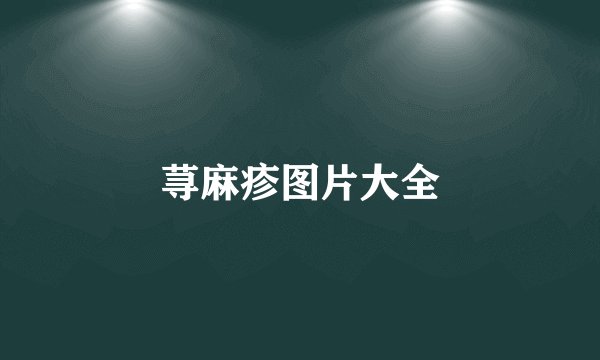 荨麻疹图片大全