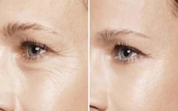 上海做双眼皮开眼角整形医院哪里好?做双眼皮开眼角口碑整形医院简介!