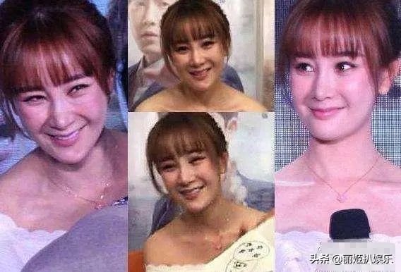 哪些女星本是天生丽质，却因整容整残了？