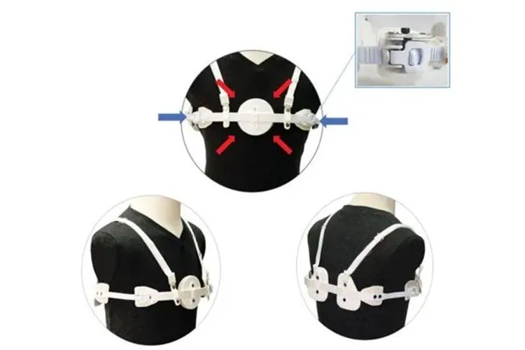 鸡胸矫正器图片