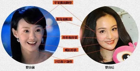 哪些女星本是天生丽质，却因整容整残了？