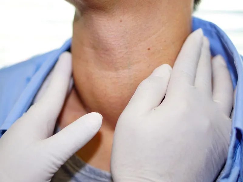 甲状腺结节饮食注意什么