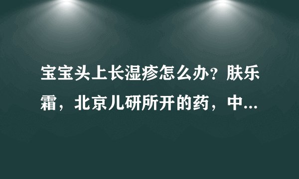 宝宝头上长湿疹怎么办？肤乐霜，北京儿研所开的药，中药成分，很管用