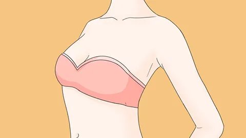 硅胶隆胸手术失败怎么修复