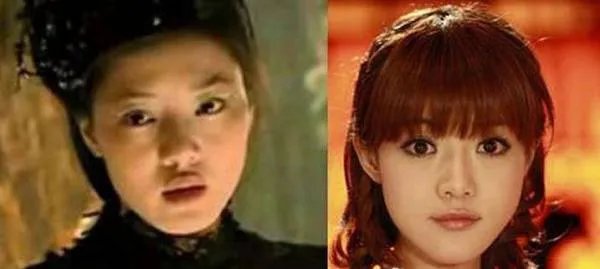 邓家佳整容了吗？