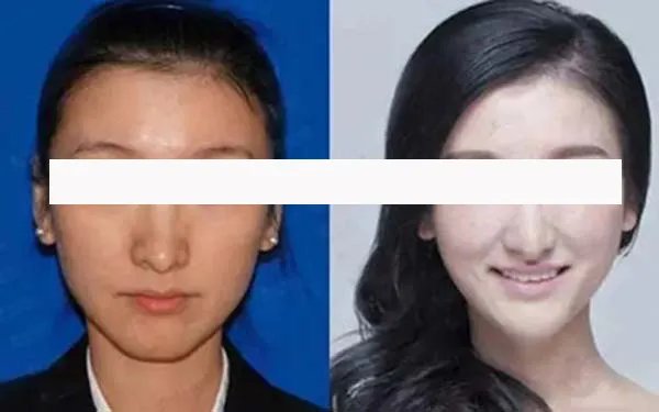 北京右脸歪美容整形医院有哪些_正规右脸歪医疗整形医院哪里好【附价格】